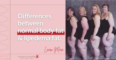 normal-fat-vs-lipedema-fat