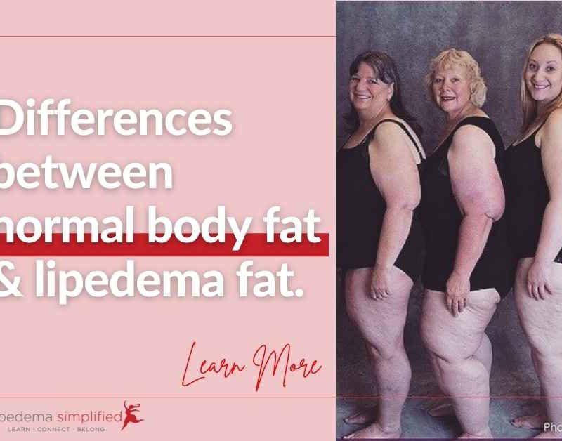 normal-fat-vs-lipedema-fat