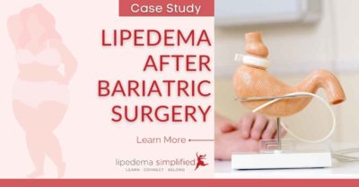 lipedema-after-bariatric-surgery
