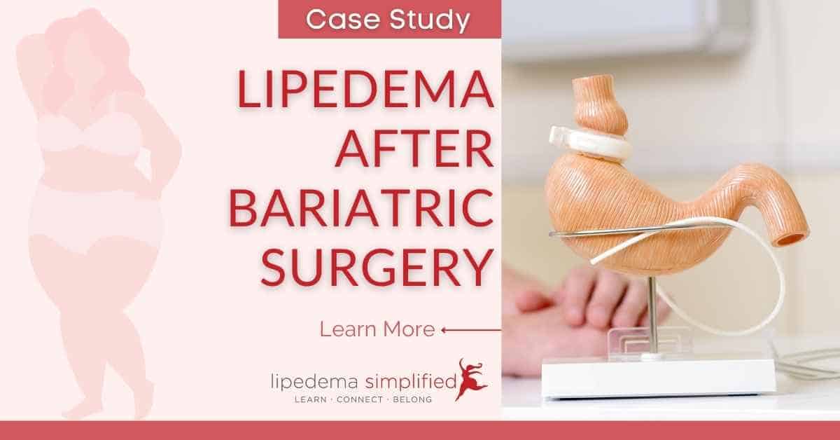 Learn About Lipedema Nutrition Before Surgery