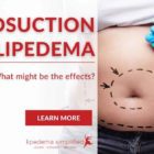 liposuction-for-lipedema