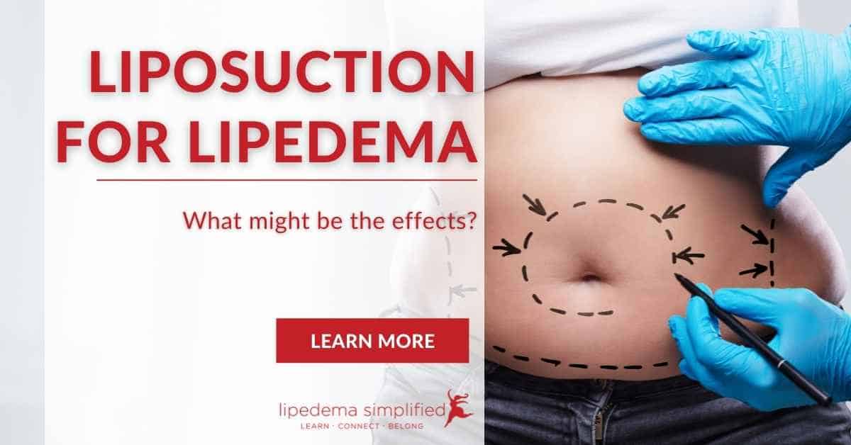 liposuction-for-lipedema