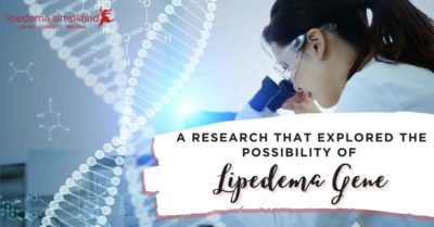 research-that-explored-lipedema-gene