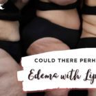 could-there-be-edema-with-lipedema