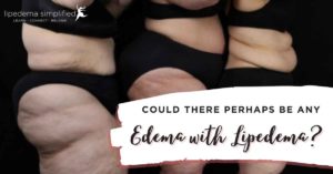 could-there-be-edema-with-lipedema
