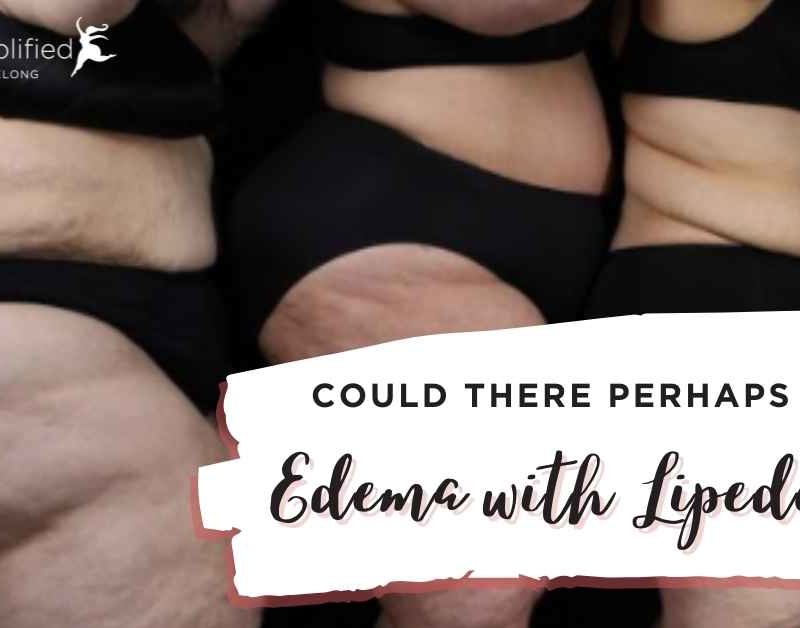 could-there-be-edema-with-lipedema