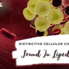 cellular-characteristics-in-lipedema