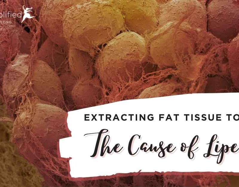 discerning-cause-of-lipedema