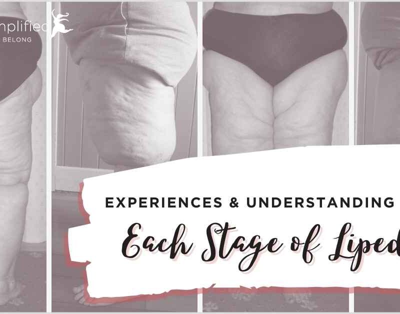 Preview of lipedema legs showing possible stages of lipedema