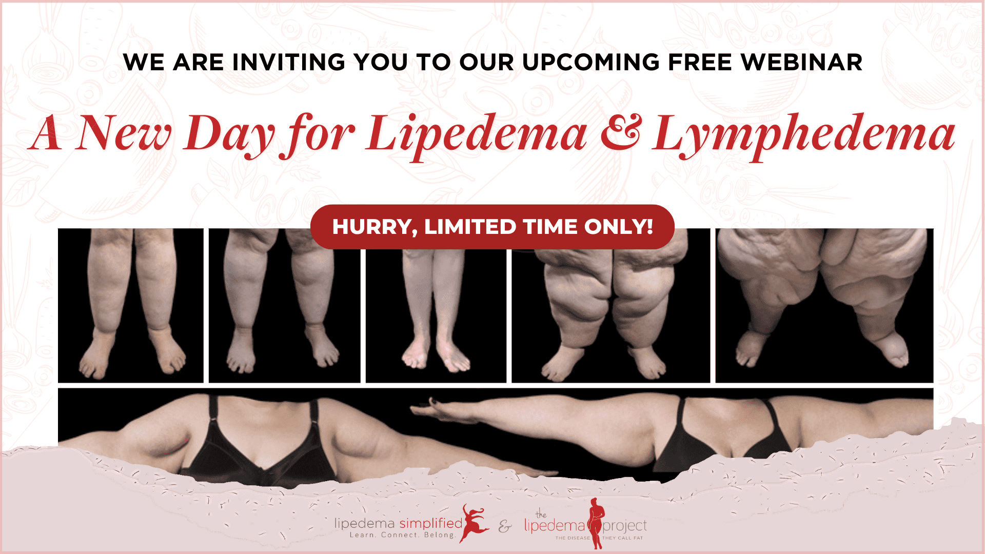 Lipedema Simplified Upcoming Free Webinars