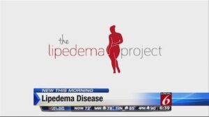 Lipedema Project logo in Local 6 News