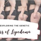 A study exploring the genetic factors of lipedema